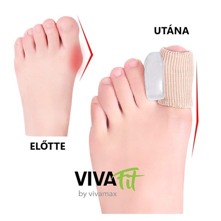 Inel protector monturi cu despărțitor din silicon pentru degetul mare - vivafit